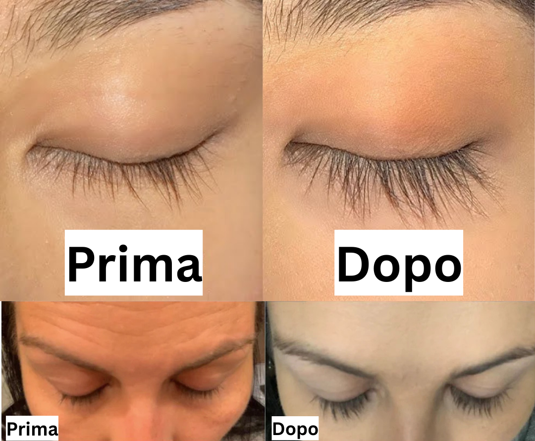 Your paragraph text (11)